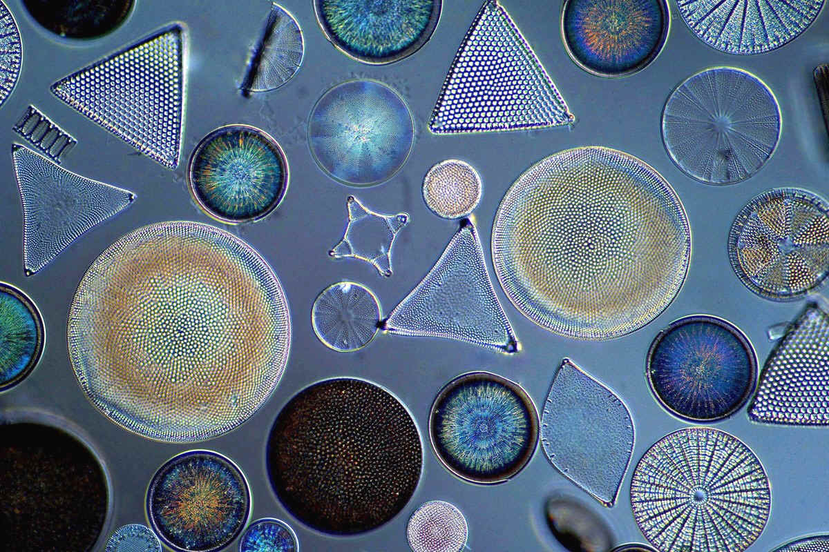 diatoms under microscope labeled